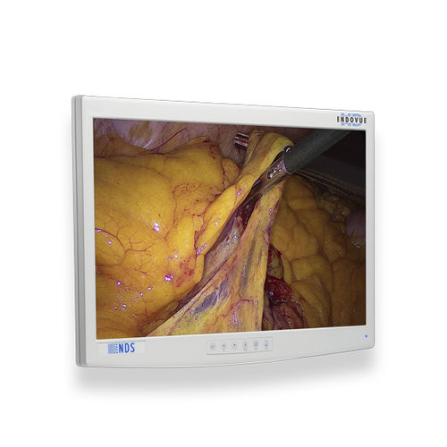 Monitor médico-hospitalar - EndoVue®  - NDS Surgical Imaging - para exames de imagem / para endoscopia / cirúrgico