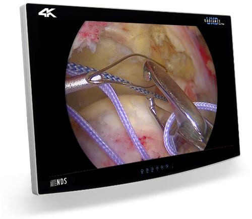 Monitor para endoscopia - RADIANCE® ULTRA - NDS Surgical Imaging - com resolução 4K / HD / 32"