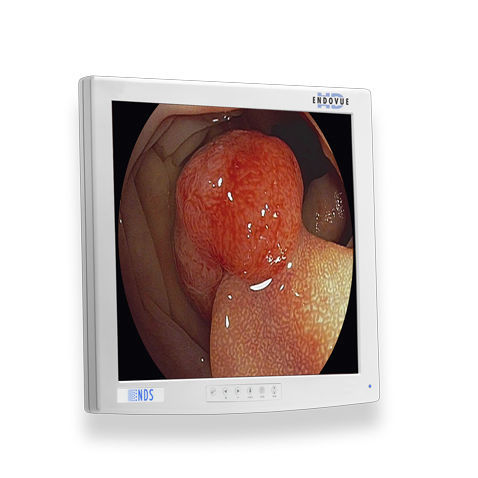 Monitor médico-hospitalar - ENDOVUE® - NDS Surgical Imaging - para exames de imagem / para endoscopia / de alta definição