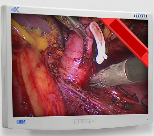Monitor médico-hospitalar - EndoVue Plus  - NDS Surgical Imaging - para endoscopia / de alta definição / 32"