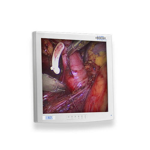 Monitor médico-hospitalar - EndoVue®Plus - NDS Surgical Imaging - para endoscopia / cirúrgico / de alta definição