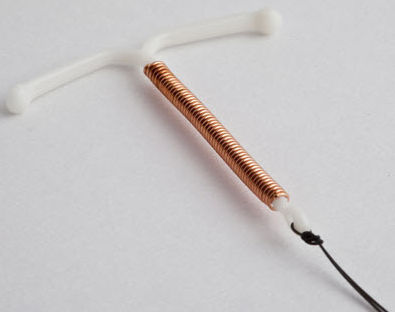 Dispositivo intrauterino de cobre em T - SILVERLINE CU 380 AG - Pregna International