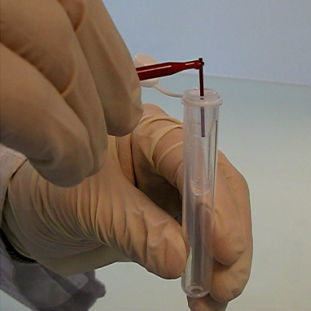Kit de reagentes em solução - PN 2015 - Sebia  - de diagnóstico / para diabetes / de laboratório