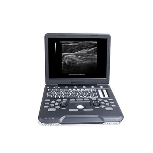 Aparelho de ultrassom portátil - Apogee 1000 - SIUI - geral / com Doppler colorido