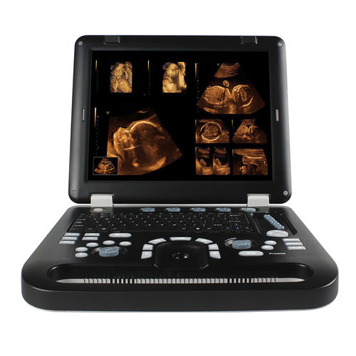 Aparelho de ultrassom portátil - CMS1700A - Sino-Hero - geral / em preto e branco / 3D/4D