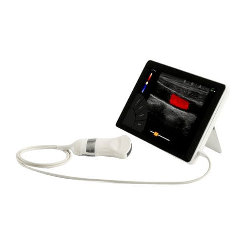 Aparelho de ultrassom portátil - T-Lite - Sonoscanner - abdominal e pélvico / geral / ginecológico e obstétrico
