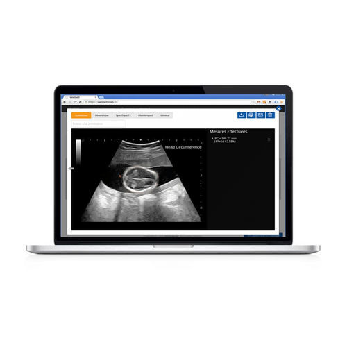 Software de análise - Sonoscanner - Sonoscanner - para exames de imagem