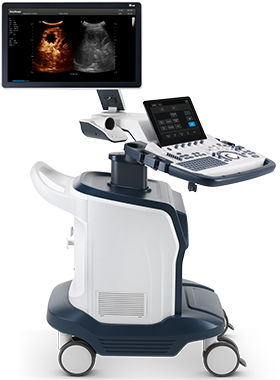 Aparelho de ultrassom com carrinho - S60 - SonoScape - geral / com Doppler colorido / 3D/4D