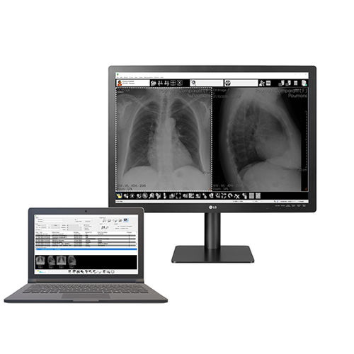 Software para radiologia - Med Diag - Stephanix - de gestão / de visualização / de diagnóstico