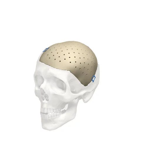 Prótese craniana sob medida - Cranial iD - Stryker