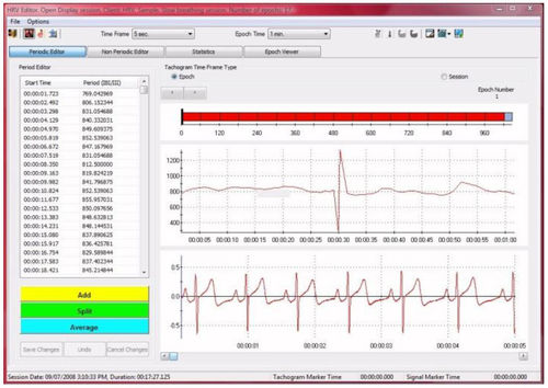 Módulo de software para eletrofisiológia - CardioPro Infiniti - Thought Technology - de análise