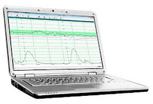 Software de análise - 902320 - Wallach Surgical Devices - médico-hospitalar / de registro clínico / para hospital