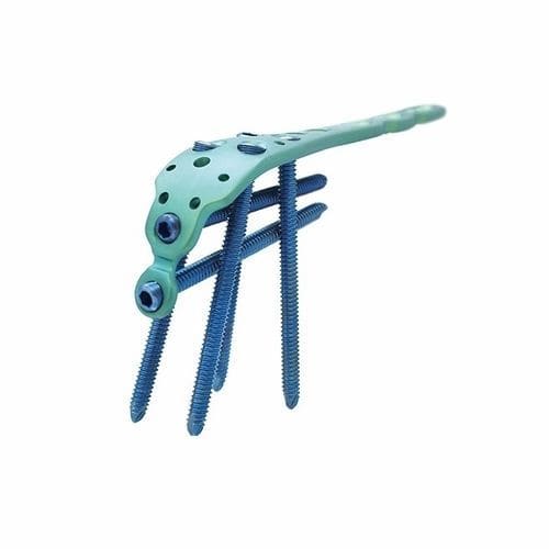 Placa de osteotomia para cúbito - Double Medical Technology - para olécrano / proximal / bloqueada