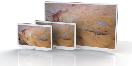 Monitor cirúrgico - XION medical - 32" / 27" / 23,8"