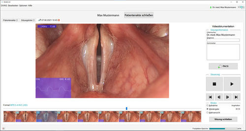 Software de análise - Phoniatrics - XION medical - médico-hospitalar / para endoscopia / de ORL