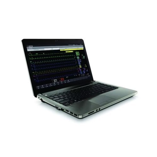 Software visualizador - BeneVision CMS  - Mindray North America - de gestão do workflow ECG em linha / de alarme / de registro clínico