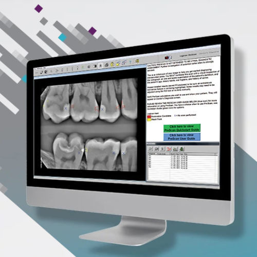 Software de detecção de cáries - Logicon Caries Detector - Carestream Dental - de visualização / de análise / de gestão de dados
