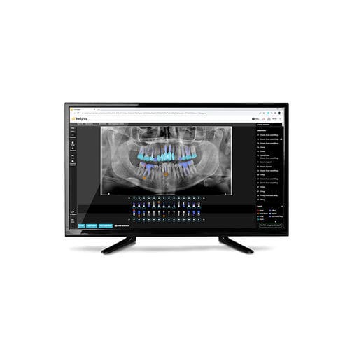 Software de análise - AI Insights - Carestream Dental - de diagnóstico / de criação de laudos / de análise de imagens