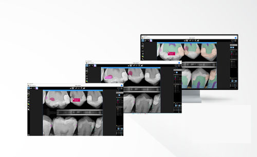Software de visualização - Pearl's Second Opinion&reg; - Carestream Dental - de análise / de diagnóstico / de criação de laudos