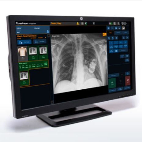 Software de análise - ImageView - Carestream - de controle / de controle de infeções / visualizador