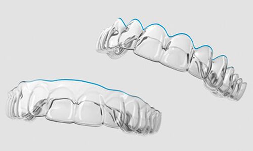 Aparelho miofuncional transparente - SureSmile® - Dentsply Sirona