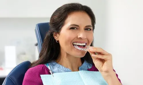 Aparelho miofuncional transparente - SureSmile® - Dentsply Sirona