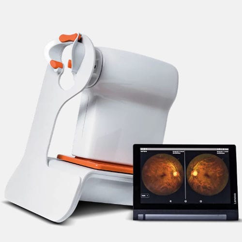 Retinógrafo não midriático - Nexy A.I. - Visionix