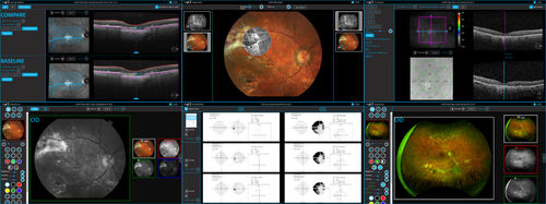 Software de análise - AXIS™ - Sonomed Escalon - de gestão / de controle / para hospital