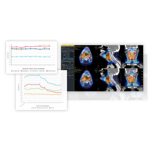 Software de criação de laudos - PreciseART® - Accuray - de planejamento / de análise de dados / para radiologia