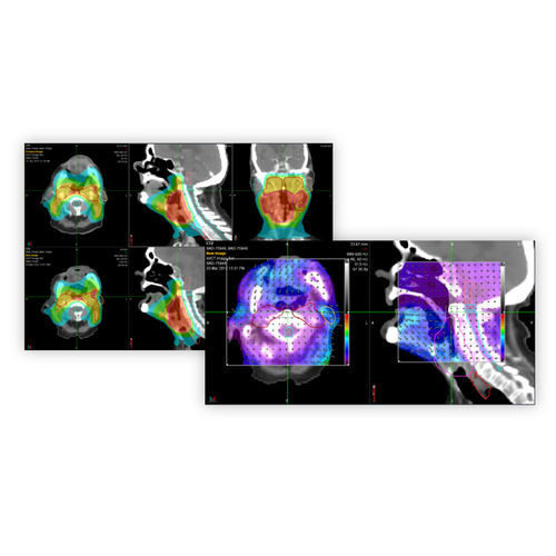 Software de planejamento de tratamento - PreciseRTX® - Accuray - para TC / de gestão de doses de radiação / para tablet