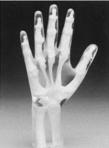 Fantoma para radiografia - Capintec - de mão