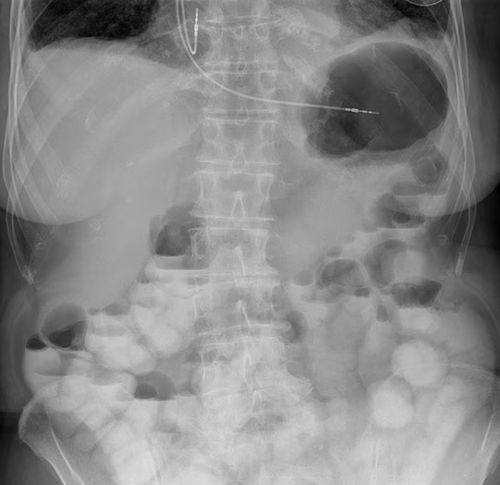 Software de visualização - UNIQUE 2 - Philips Healthcare - de diagnóstico / de monitorização de dose de radiação / de planejamento