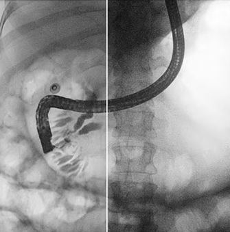 Software de melhoramento de imagens - Dynamic UNIQUE - Philips Healthcare - de diagnóstico / médico-hospitalar / para radiologia