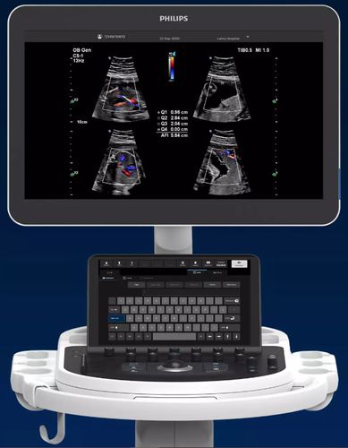 Aparelho de ultrassom móvel - Elevate Plus - Philips Healthcare - geral / em preto e branco / com tela sensível ao toque