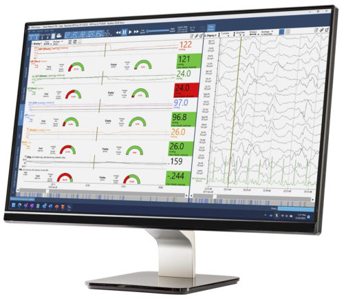 Software de análise - Moberg CNS - Natus Hearing & Balance - de gestão / de monitorização / de tratamento