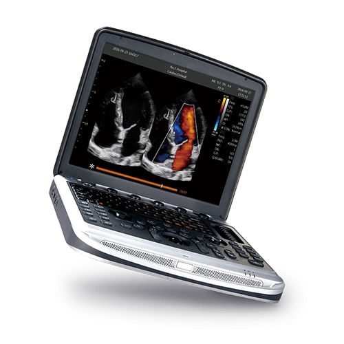 Aparelho de ultrassom portátil - SonoBook 8 - CHISON Medical Technologies - geral / em preto e branco / com Doppler colorido