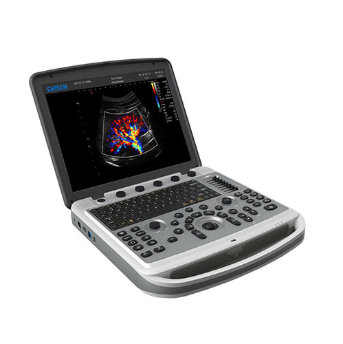 Ultrassom veterinário portátil - SonoBook 6 - CHISON Medical Technologies - multiuso / em preto e branco / com Doppler colorido
