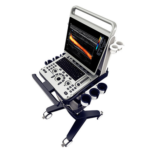 Aparelho de ultrassom móvel - EBit 30 - CHISON Medical Technologies - geral / com Doppler colorido / em preto e branco