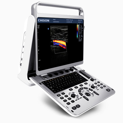 Aparelho de ultrassom portátil - EBit 20 - CHISON Medical Technologies - geral / ginecológico e obstétrico / abdominal e pélvico