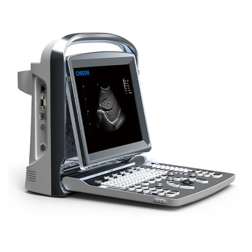 Aparelho de ultrassom portátil - ECO 1 - CHISON Medical Technologies - geral / em preto e branco / com console integrada