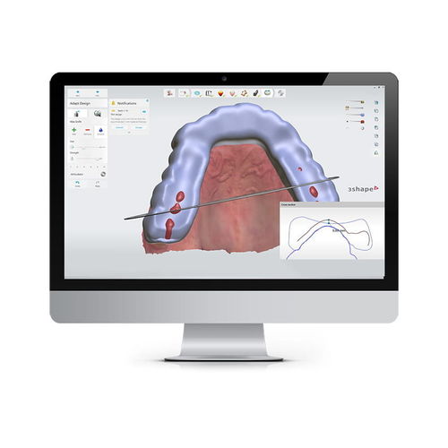 Software de controle - SPLINT STUDIO - 3shape - de tratamento / de design / de importação
