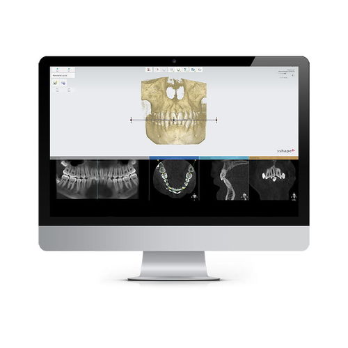 Software de planejamento de tratamento - Ortho Planner - 3shape - de análise / de gravação / de design