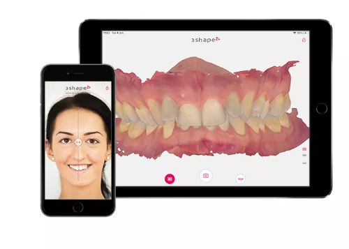 Software de design digital de sorriso - 3shape - de tratamento / de captura / de simulação