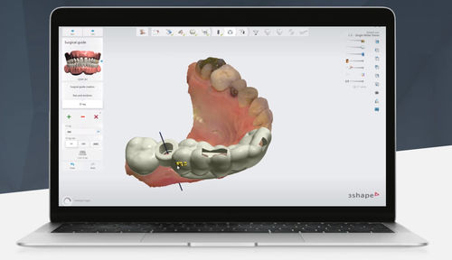 Software de planejamento - Implant Studio™ - 3shape - de tratamento / CAD / de concepção de prótese dentária