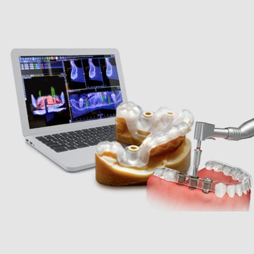 Software para cirurgia guiada - Implant3D - B&B DENTAL - de análise / de visualização 3D / para implantodontia