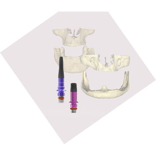 Implante dentário cilíndrico - BTI Biotechnology Institute - em titânio / reto
