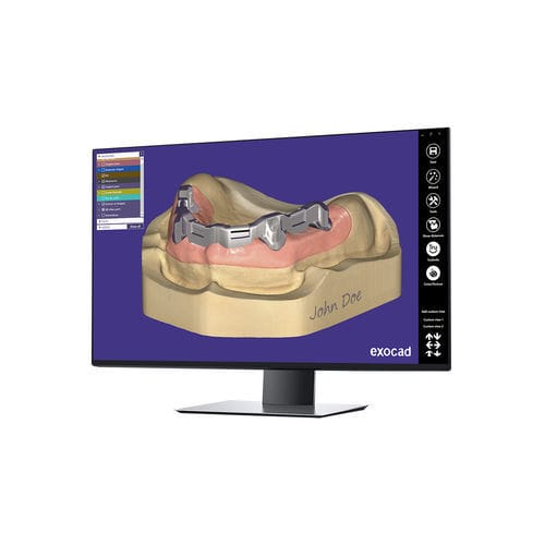 Módulo de software de medição - Bar - exocad GmbH   - de design / CAM / clínico