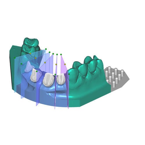 Módulo de software de captura - Model Creator - exocad GmbH   - de design / de modelagem / odontológico