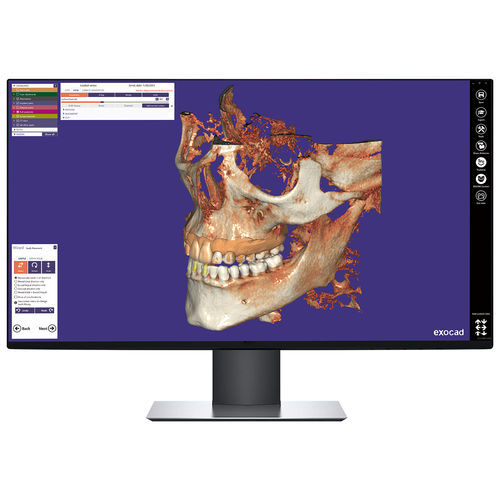 Módulo de software de visualização - DICPDCAD - exocad GmbH   - visualizador DICOM / de diagnóstico / de controle