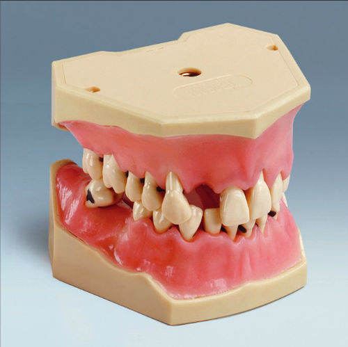 Modelo anatômico de dentição - A-PB - frasaco - para ensino